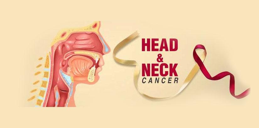 Treatment of Head and Neck Cancer in India